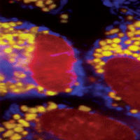 Fluorescently labeled cells confirm computational
predictions about where various medicines and chemicals accumulate inside cells. Courtesy of Gus Rosania, University of Michigan.