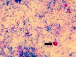 Figure 1. Cryptosporidium muris oocysts (under oil X 1,000), stained by Kinyoun's acid-fast staining.