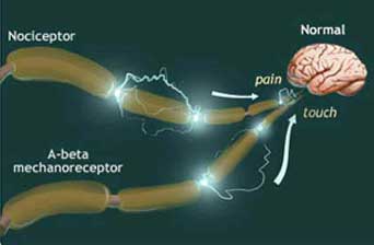 An illustration showing sustained nociceptive input over a long period leading to excitotoxicity in the brain.