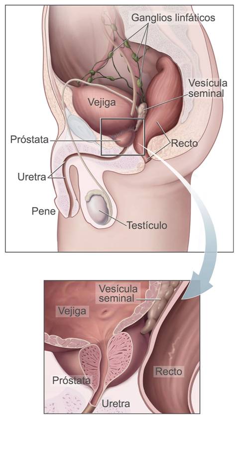 Esta ilustración muestra la próstata y órganos de su derredor. Interior de la próstata, uretra, recto y vejiga