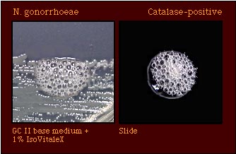 catalase