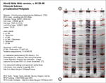 Calibrated IEF Gel Image