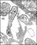 This 1977 thin sectioned transmission electron micrograph (TEM) depicted the ultrastructural details of the mumps virions that  had been grown in a Vero cell culture.