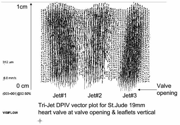 This graphic shows the Tri-Jet DPIV vector plot for St. Jude 19 mm heart halve at valve openings and leaflets vertical.  The verticle axis is in 0 to 1 cm and the horizontal axis has Valve openings for Jet 1, 2 and 3