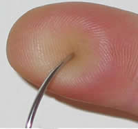 A blunt-tip needle pressing, but not piercing, skin