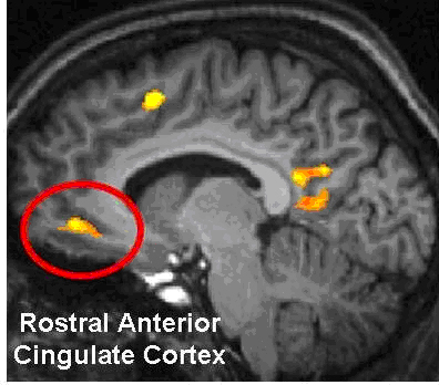 rostral anterior cingulate cortex