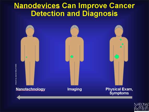 Nanodevices Can Improve Cancer Detection and Diagnosis