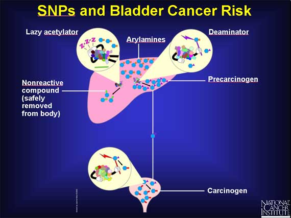SNPs and Bladder Cancer Risk