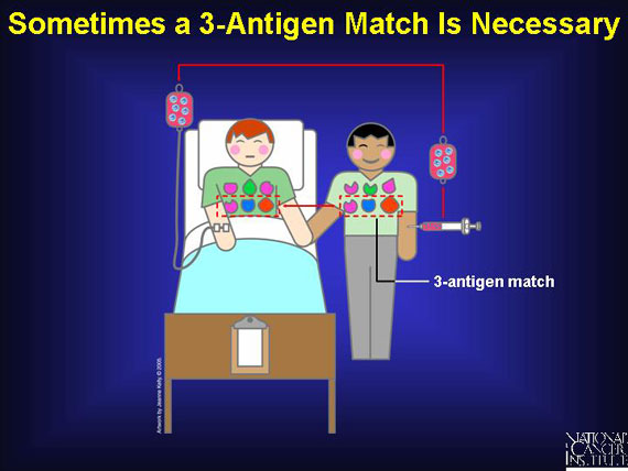 Sometimes a 3-Antigen Match Is Necessary