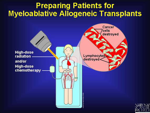 Preparing Patients for Myeloablative Allogeneic Transplants