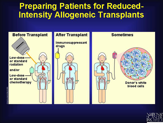 Preparing Patients for Reduced-Intensity Allogeneic Transplants
