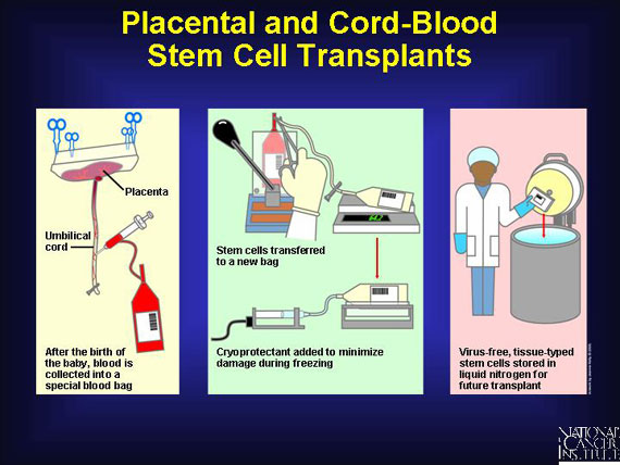 Placental and Cord-Blood Stem Cell Transplants