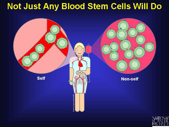 Not Just Any Blood Stem Cells Will Do