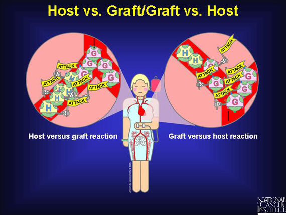 Host vs. Graft/Graft vs. Host