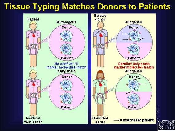 Tissue Typing Matches Donors to Patients