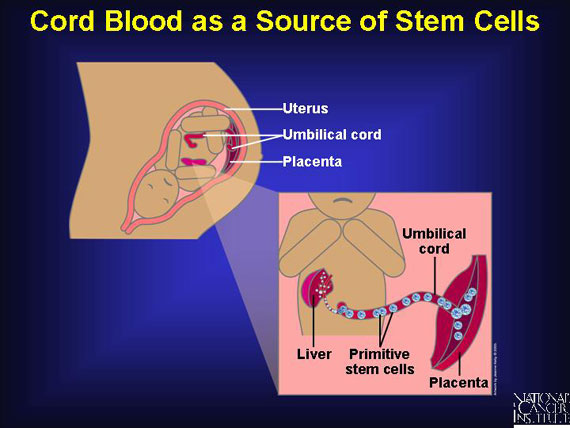 Cord Blood as a Source of Stem Cells
