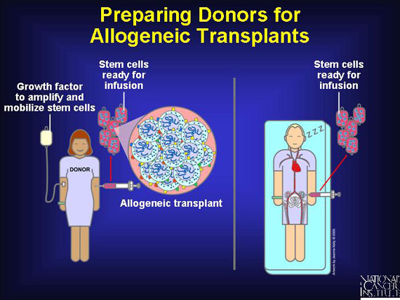 Preparing Donors for Allogeneic Transplants