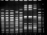 Figure. Pulsed-field gel electrophoresis of O157 isolates from the Connecticut child and the deer meat showing XbaI and BlnI-digested genomic DNA....