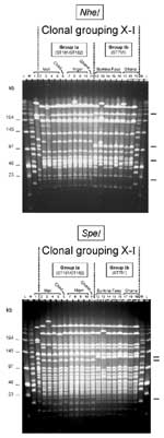 Figure 1. Two groups of pulsed-field gel electrophoresis patterns among NheI- and SpeI-digested chromosomal DNA...