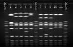 Figure 2. Pulsed-field gel electrophoresis profiles of SmaI digested DNA. NCTC, National Collection of Type Cultures 8325 control. Lane 1, vancomycin-intermediate Staphylococcus aureus (VISA) isolate from Japan, otherwise designated Mu50; lane 2, VISA isolate from Michigan (7); lane 3, VISA isolate from New Jersey (7); Lane 4, VISA isolate from New York (1); lane 5, VISA isolate from Illinois (3); lane 7, patient's oxacillin-resistant VISA; lane 8, patient's oxacillin-susceptible VISA; lane 9 patient's oxacillin-resistant S. aureus (ORSA, vancomycin MIC = 2 µg/mL) from anterior nares; lanes 10 and 11, isolates of ORSA (vancomycin MIC=2 µg/mL) from the health-care worker's anterior nares.