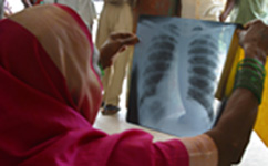 Indian TB patient
