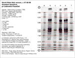 IEF Calibrated Gel image