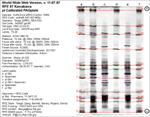 IEF Calibrated Gel image