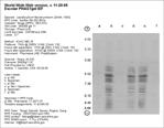 Phast Plate IEF Gel image