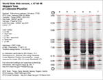 IEF Calibrated Gel image