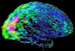 Mapping brain differences