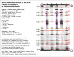 IEF Calibrated Gel image