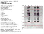 IEF Calibrated Gel image