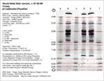 IEF Calibrated Gel image