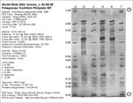 PAGPlate IEF Gel image