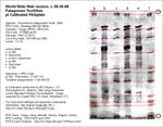 IEF Calibrated Gel image