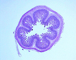 Microscope photo: Cross section of intestine from piglet on intravenous feeding shows atrophy
