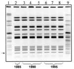 Figure. Gel showing the XbaI pulsed-field gel electrophoresis (PFGE) pattern of each isolate....