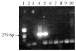 Figure. Results of the nested polymerase chain reaction (PCR) assay performed on the serum specimens from both patients and their dogs. Lane 1: standard DNA size marker V (Boehringer, Mannheim, Germany); lanes 2 and 3: serum #1 from man; lanes 4 and 5: serum #1 from woman; lanes 6 and 7: serum from dog #1; lanes 8 and 9: serum from dog #2; lane #10: negative control; lanes 2, 4, 6, and 8: pure DNA; and lanes 3, 5, 7, and 9: DNA diluted 1:10 in deionized water.