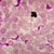 Trypanosoma brucei parasites (bright pink) surrounded by red blood cells (light pink) in a smear of infected blood. Courtesy of the Centers for Disease Control and Prevention/Dr. Mae Melvin