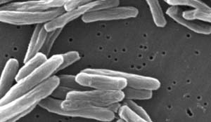 Mycobacterium tuberculosis, the bacteria that cause tuberculosis, up close