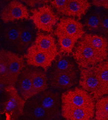 Retinal pigment epithelial (RPE) cells stained red by RPE65 antibody