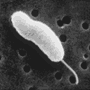 Vibrio vulnificus