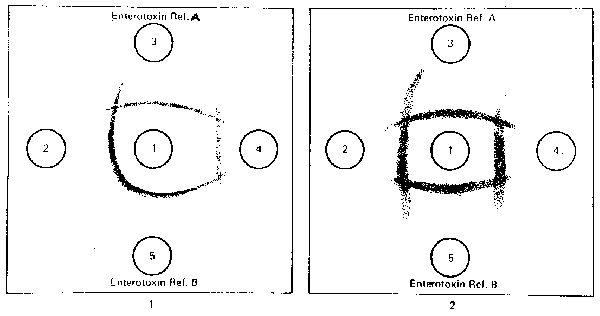 Figure 7.
 <i>S. aureus</i> enterotoxin: Precipitate patterns in microslide gel diffusion test 