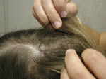 Examination of hair and scalp for head lice