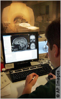 Radiographie d'un cerveau humain
