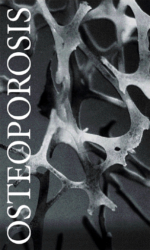 Artwork for the conference showing a black and white image of osteoporotic bone. 