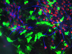 Neural crest cells with placode cells expressing neuronal markers.