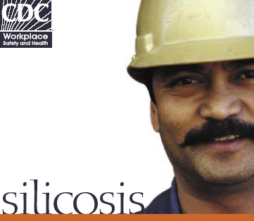 silicosis