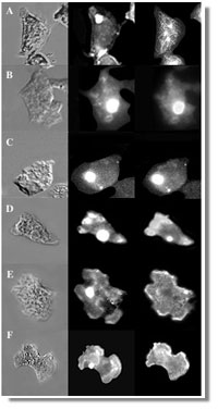 Dictyostelium cells containing Hirano bodies