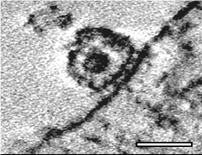 Schematic shows the entry claw at the virus-cell contact region.